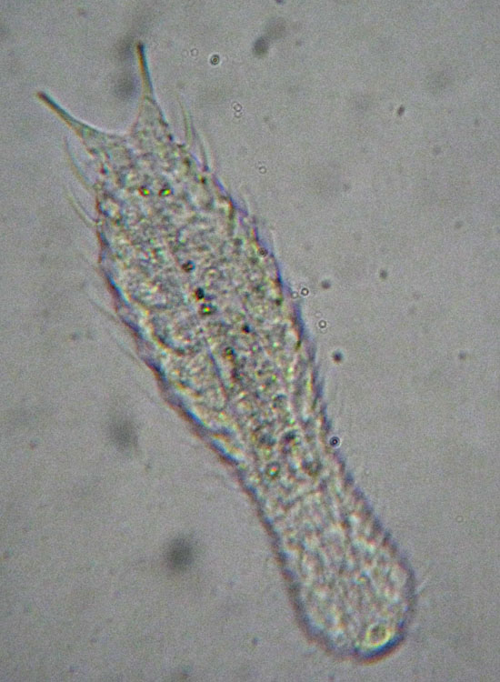 Due Gastrotricha  -  Chaetonotus sp.